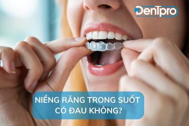 Niềng răng trong suốt có đau không