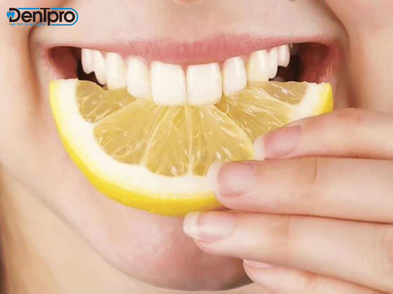 Tẩy trắng răng tại nhà